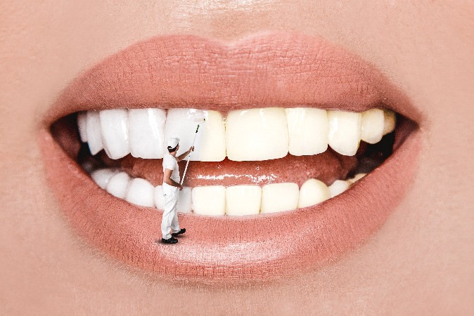 Pourquoi utiliser une lampe de blanchiment dentaire