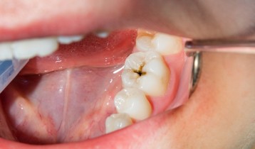 Produits à risque : Soins bucco-dentaires autres - Comparatif