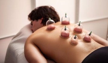 Quels sont les bienfaits du massage du dos avec des ventouses ?